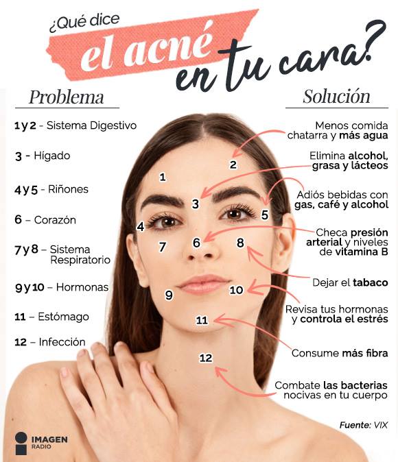 rostro acne