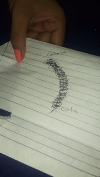 culebrilla2